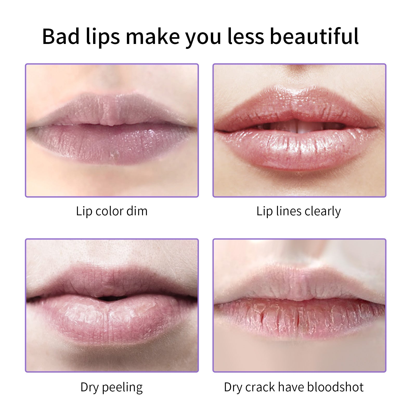 SHELOVES Repair Lip Balm Hydrating &Prevention Dry and Crack Lip Scrubs Exfoliator 10g
